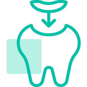 Root Canal Treatment